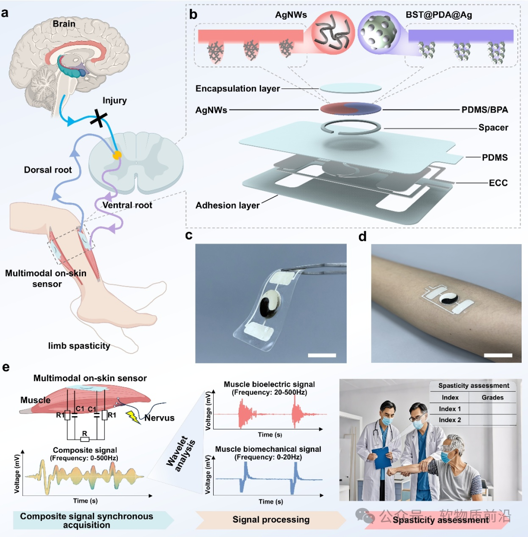Professor Wu Hao from Huazhong University of Science and Technology: A Multi-modal Hydrogel Epidermal Sensor for Synchronous Acquisition of Biomechanical and Bioelectrical Signals to Detect and Assess Muscle Spasticity