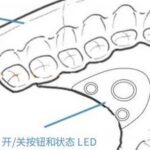 Somnair: The Invisible Dental Appliance That Can Treat Snoring