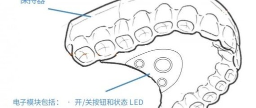 Somnair: The Invisible Dental Appliance That Can Treat Snoring
