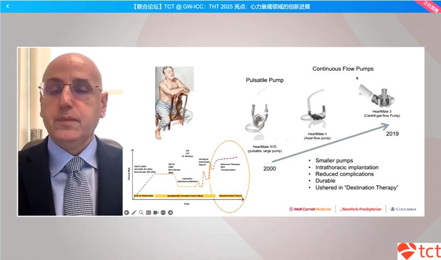 GW-ICC/AHS.25 | THT 2025 Highlights: Insights into Innovations in Heart Failure Treatment