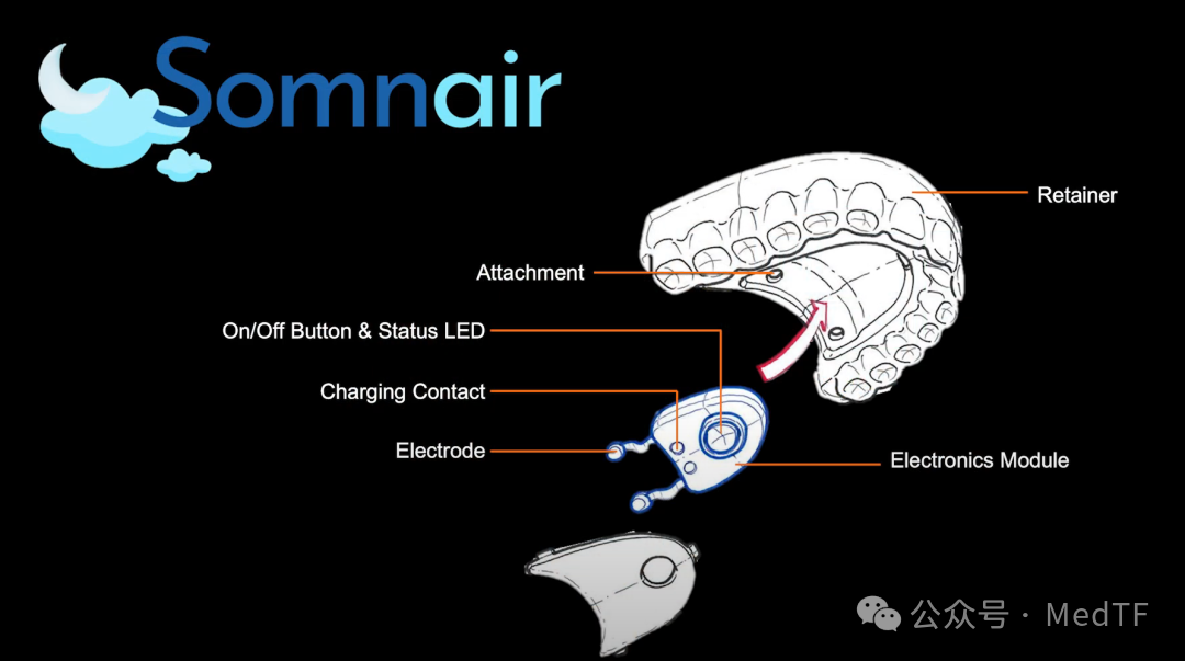 Somnair: The Invisible Dental Appliance That Can Treat Snoring