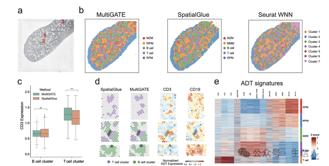 Breaking Through the Challenges of Spatial Multi-Omics Integration! The MultiGATE Tool Emerges to Precisely Decode Tissue Microenvironments and Regulatory Networks