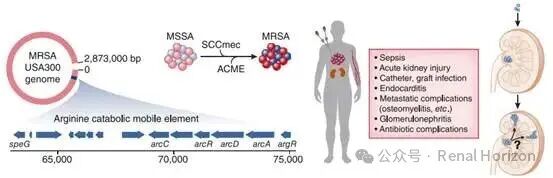 Molecular Mechanisms of Sepsis-Associated Acute Kidney Injury