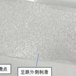 How Long Do 3D Printed Insoles Last?