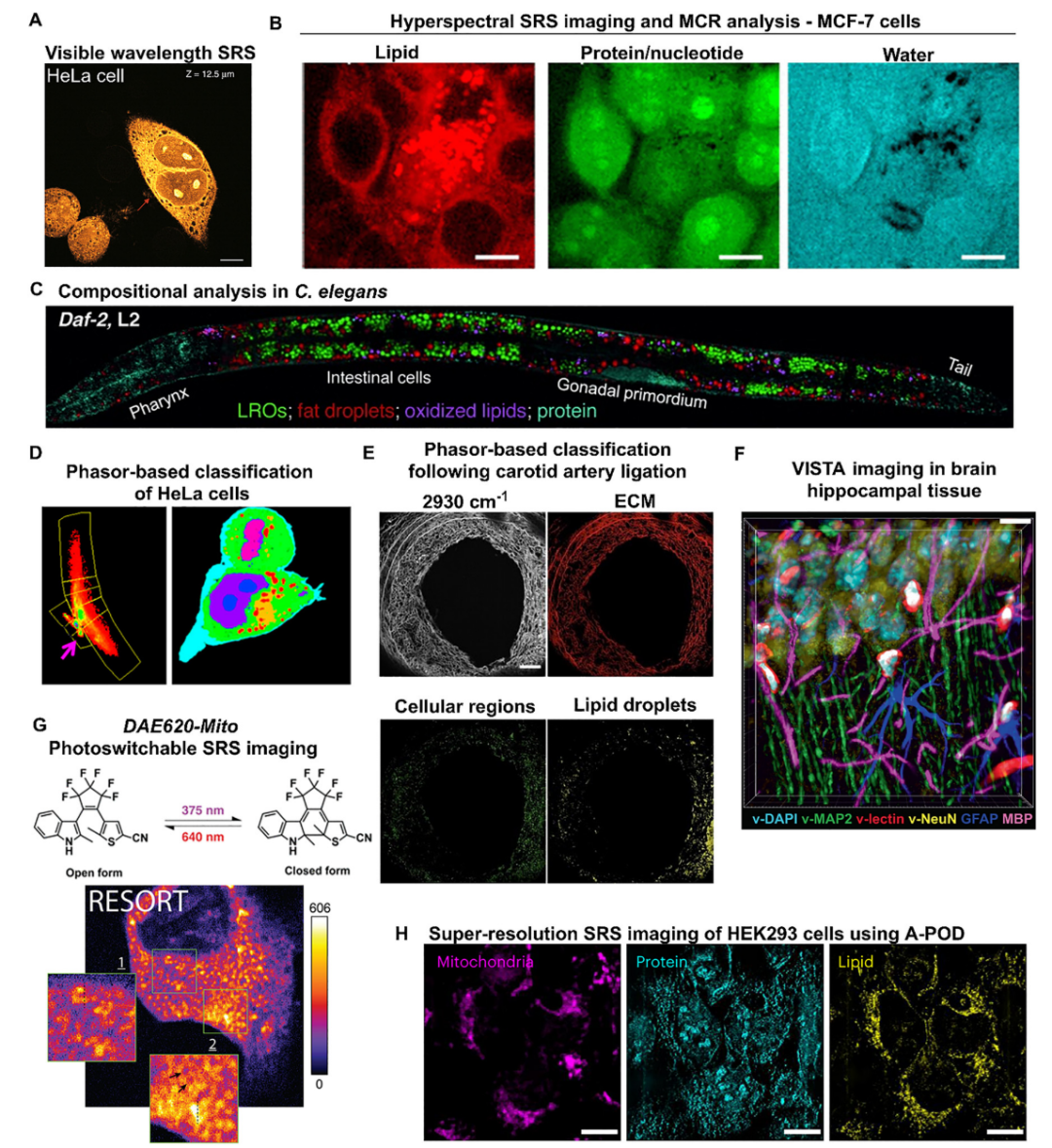 Emerging Applications of Stimulated Raman Scattering Microscopy for Medicinal Chemistry and Drug Discovery