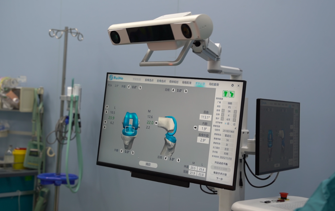 The Future is Here! AI Orthopedic Robots Achieve Human-Machine Collaboration