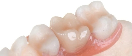 Comparative Study on the Fabrication of Fixed Partial Dentures Using Different 3D Printing Technologies