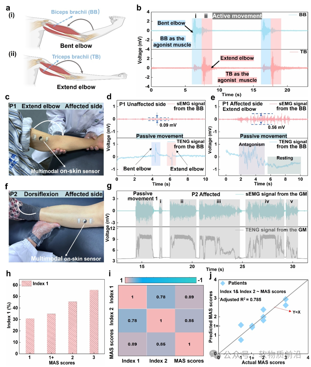Professor Wu Hao from Huazhong University of Science and Technology: A Multi-modal Hydrogel Epidermal Sensor for Synchronous Acquisition of Biomechanical and Bioelectrical Signals to Detect and Assess Muscle Spasticity