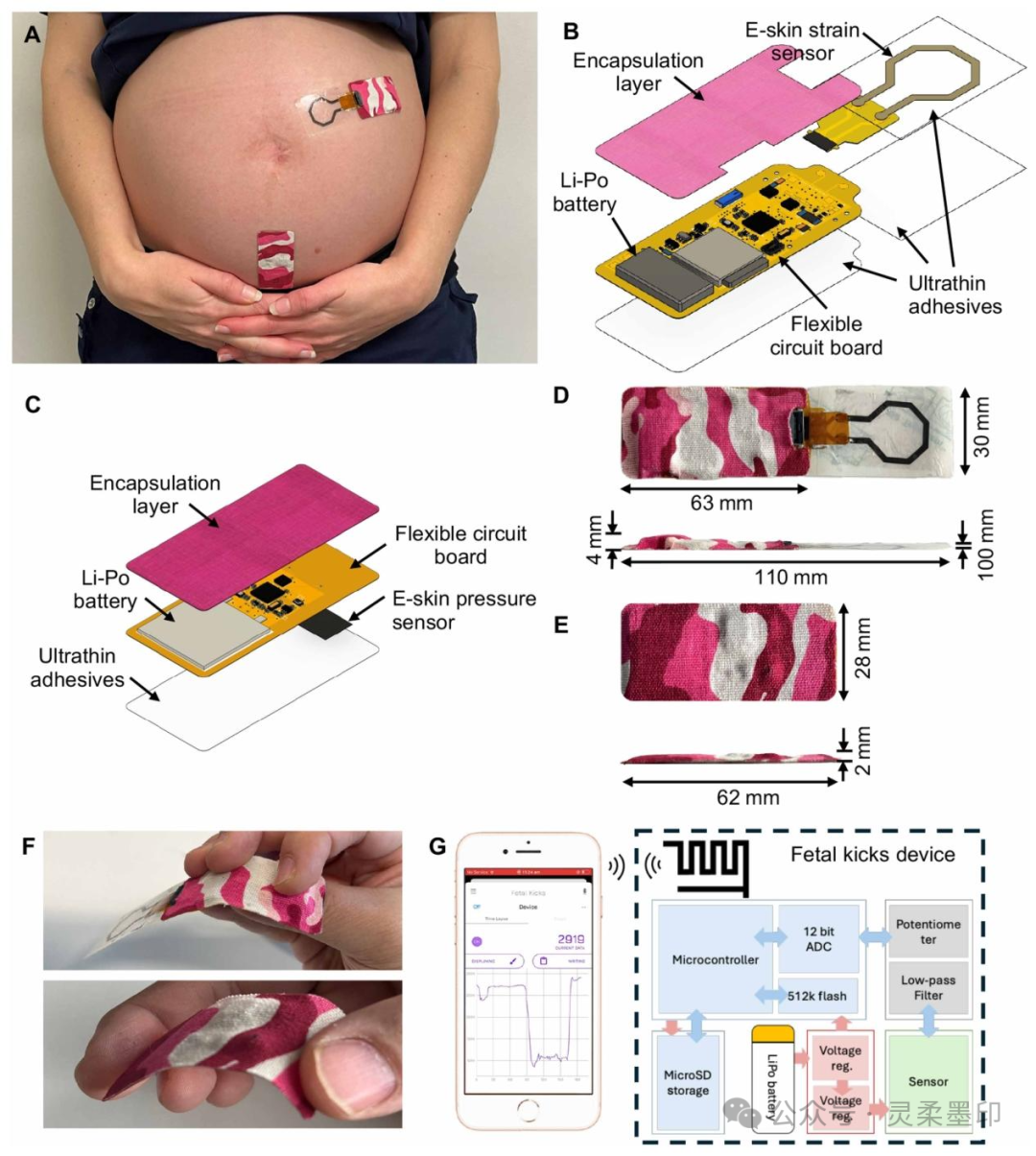 New Breakthrough in Fetal Movement Monitoring During Pregnancy! A Sensor the Size of a Band-Aid for Accurate Maternal and Infant Safety