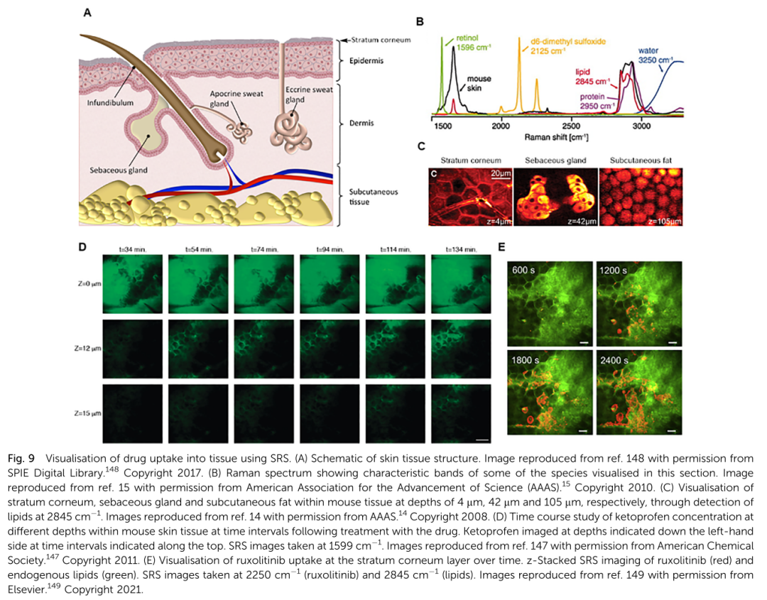 Emerging Applications of Stimulated Raman Scattering Microscopy for Medicinal Chemistry and Drug Discovery