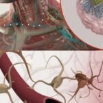 Definition of Injectable Brain Chip Technology