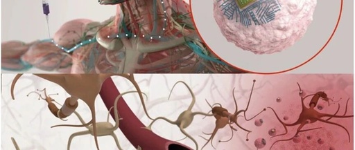 Definition of Injectable Brain Chip Technology