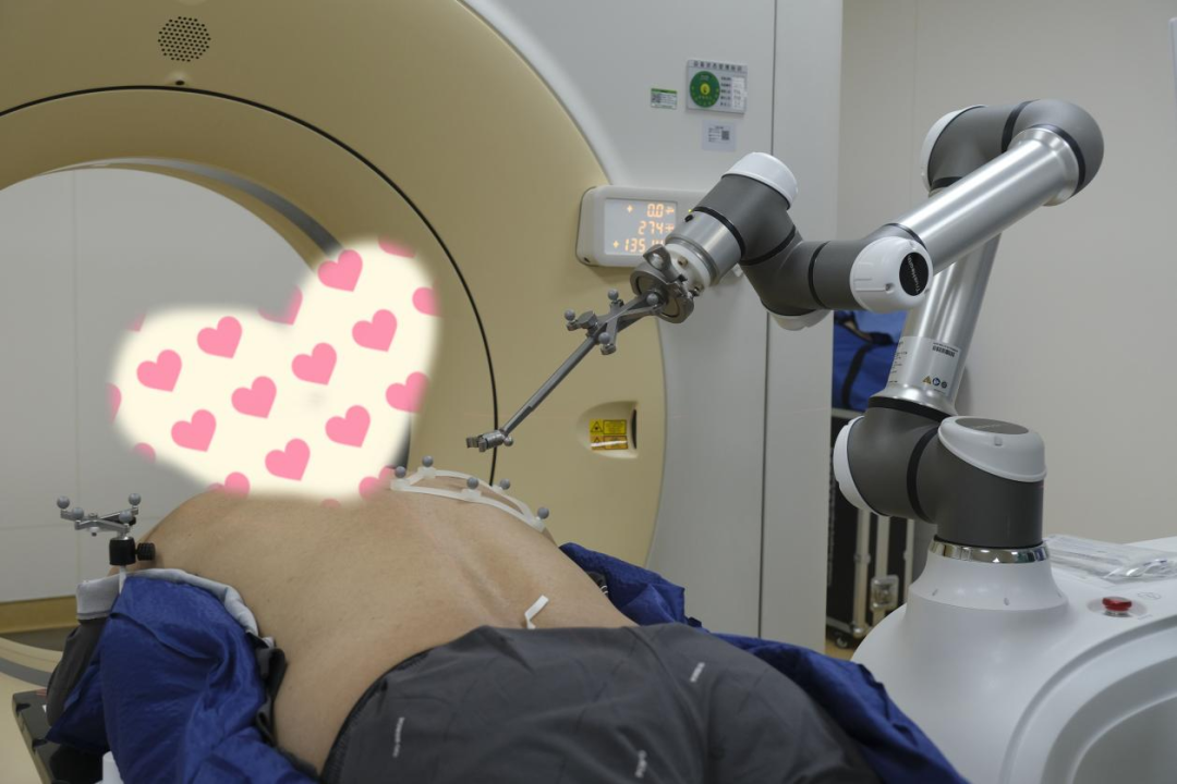 AI Robot Takes Office at This Hospital to Assist in Minimally Invasive Lung Cancer Treatment