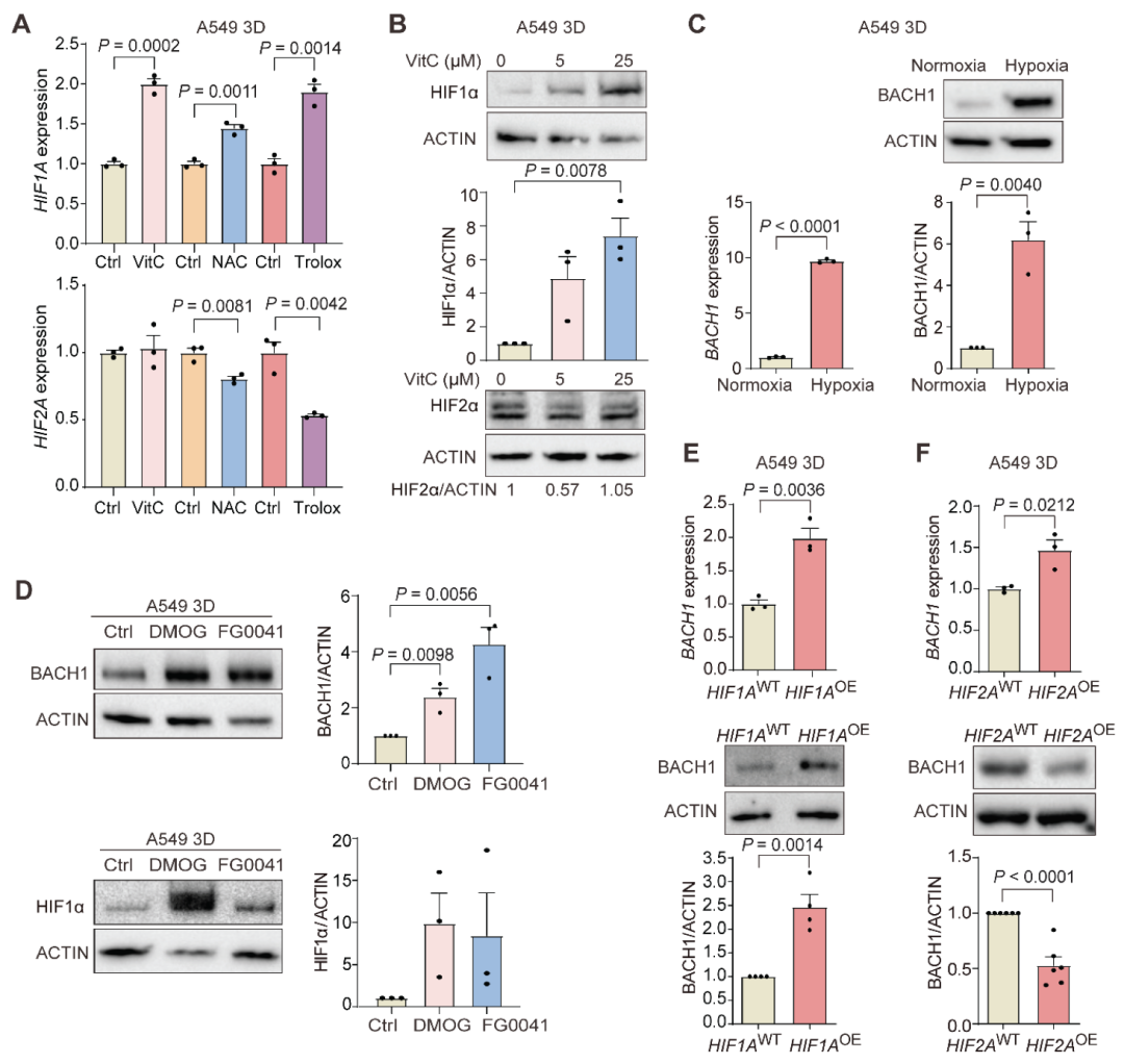 Vitamin Supplementation Should Be Needs-Based! Supplementing 'Antioxidant' Vitamins C and E May Increase Tumor Progression and Metastasis