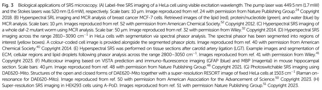 Emerging Applications of Stimulated Raman Scattering Microscopy for Medicinal Chemistry and Drug Discovery