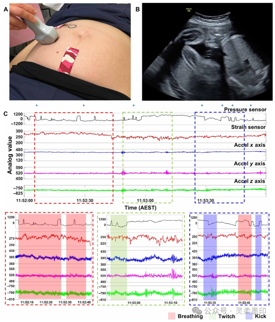 New Breakthrough in Fetal Movement Monitoring During Pregnancy! A Sensor the Size of a Band-Aid for Accurate Maternal and Infant Safety