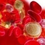 Is Vitamin C a Waste or a Remedy for Sepsis?