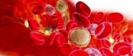 Is Vitamin C a Waste or a Remedy for Sepsis?