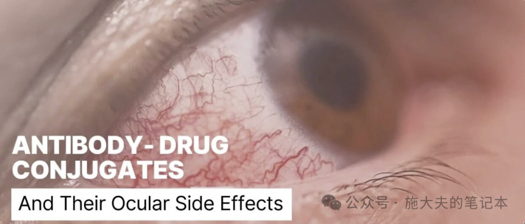 T-DXd vs Dato-DXd: Differences in Toxicity in Lungs and Eyes with Same Payload, While SG and Trastuzumab Deruxtecan Remain Safe