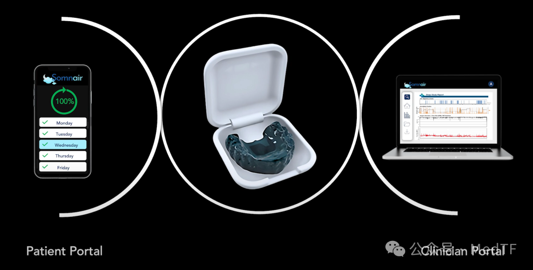 Somnair: The Invisible Dental Appliance That Can Treat Snoring