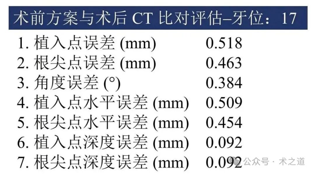 Advantages of the 'ZhiZhi π' Dental Implant Robot-Assisted Implantation Technology in the Maxillary Molar Region