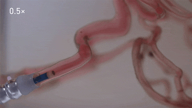 Breakthrough: Scientists Create Microrobots for Precise Drug Delivery Inside the Body, Ready for Human Clinical Trials