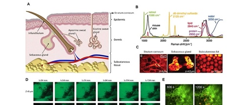 Emerging Applications of Stimulated Raman Scattering Microscopy for Medicinal Chemistry and Drug Discovery