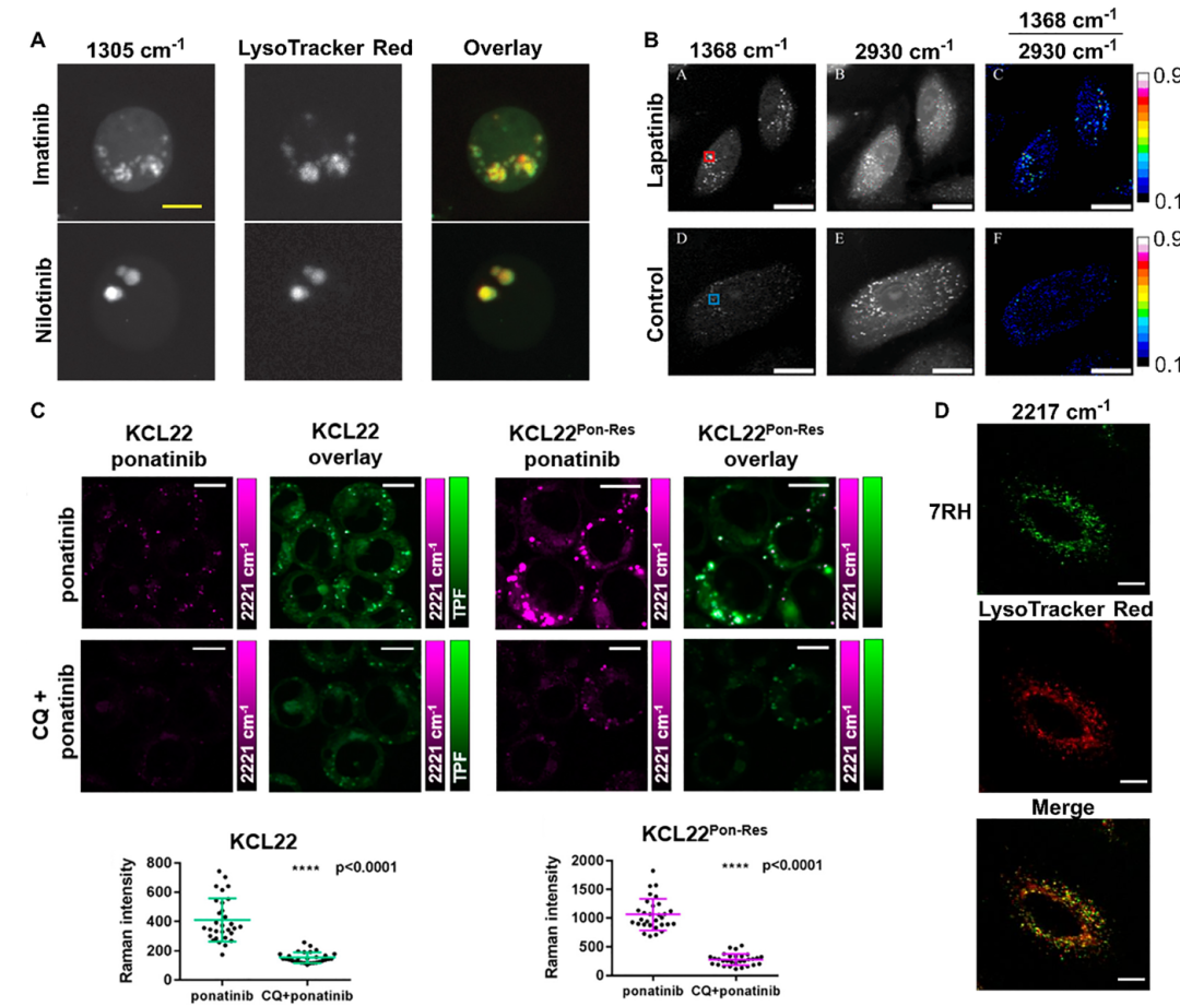 Emerging Applications of Stimulated Raman Scattering Microscopy for Medicinal Chemistry and Drug Discovery
