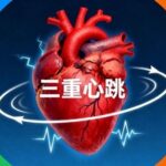 Understanding the 'Triple Heartbeat' of PLC: Breaking the Cognitive Barrier from Electrician to Engineer